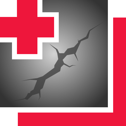 Strive Concrete Crack Repair